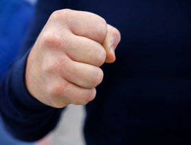 Житель Кобрина избивал собственную мать и сломал ей ногу
